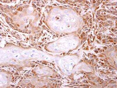 Immunohistochemistry-Paraffin: ITPA Antibody [NBP1-32494] - Paraffin-embedded Ca922 xenograft. ITPase antibody [N1C3]  dilution: 1:500.