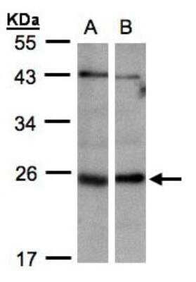 Western Blot: ITPA Antibody [NBP1-32494] - Sample(30 ug whole cell lysate)  A:293T B:Hep G2 12% SDS PAGE, antibody diluted at 1:1000.