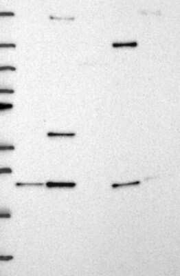 Western Blot: ITPA Antibody [NBP3-17266] - Lane 1: Marker [kDa] 250, 130, 95, 72, 55, 36, 28, 17, 10;   Lane 2: RT4;   Lane 3: U-251 MG;   Lane 4: Human Plasma;   Lane 5: Liver;   Lane 6: Tonsil