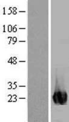 Western Blot: ITPA Overexpression Lysate (Adult Normal) [NBL1-12086] Left-Empty vector transfected control cell lysate (HEK293 cell lysate); Right -Over-expression Lysate for ITPA.