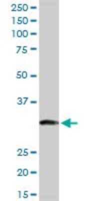 Western Blot: ITPK1 Antibody [H00003705-D01P] - Analysis of ITPK1 expression in human liver.