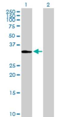 Western Blot: ITPK1 Antibody [H00003705-D01P] - Analysis of ITPK1 expression in transfected 293T cell line by ITPK1 polyclonal antibody.Lane 1: ITPK1 transfected lysate(35.60 KDa).Lane 2: Non-transfected lysate.