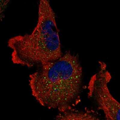 Immunocytochemistry/Immunofluorescence: ITPKA Antibody [NBP1-81590] - Staining of human cell line U-251 MG shows localization to vesicles. Antibody staining is shown in green.