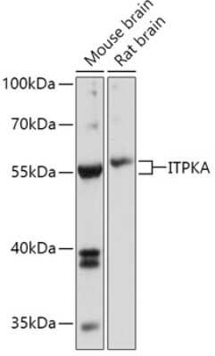 Western Blot: ITPKA Antibody [NBP3-04719] - Analysis of extracts of various cell lines, using ITPKA antibody at 1:1000 dilution. Secondary antibody: HRP Goat Anti-Rabbit IgG (H+L) at 1:10000 dilution. Lysates/proteins: 25ug per lane. Blocking buffer: 3% nonfat dry milk in TBST. Detection: ECL Basic Kit