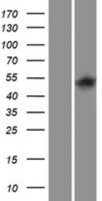 Western Blot: ITPKA Overexpression Lysate (Adult Normal) [NBP2-08138] Left-Empty vector transfected control cell lysate (HEK293 cell lysate); Right -Over-expression Lysate for ITPKA.