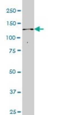 Western Blot: ITPKB Antibody (2F8) [H00003707-M01] - ITPKB monoclonal antibody (M01), clone 2F8 Analysis of ITPKB expression in Jurkat.