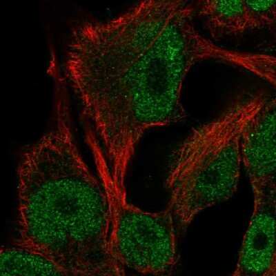 Immunocytochemistry/Immunofluorescence: ITPKB Antibody [NBP2-57395] - Staining of human cell line SK-MEL-30 shows localization to nucleoplasm. Antibody staining is shown in green.