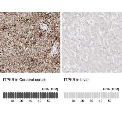 Immunohistochemistry-Paraffin: ITPKB Antibody [NBP1-81589] - Analysis in human cerebral cortex and liver tissues. Corresponding ITPKB RNA-seq data are presented for the same tissues.