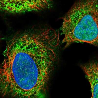 Immunocytochemistry/Immunofluorescence: ITPR2 Antibody [NBP2-56474] - Staining of human cell line U-2 OS shows localization to nucleus & endoplasmic reticulum.