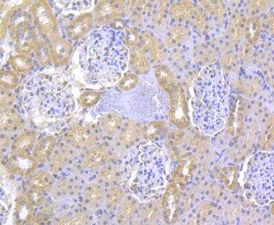 Immunohistochemistry: ITPR2 Antibody [NBP2-76937] - Immunohistochemical analysis of paraffin-embedded rat kidney tissue using anti-ITPR2 antibody. Counter stained with hematoxylin.