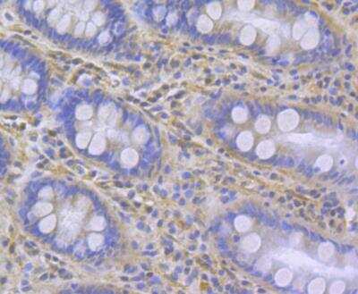 Immunohistochemistry: ITPR2 Antibody [NBP2-76937] - Immunohistochemical analysis of paraffin-embedded human colon tissue using anti-ITPR2 antibody. Counter stained with hematoxylin.