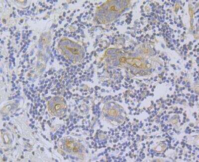 Immunohistochemistry: ITPR2 Antibody [NBP2-76937] - Immunohistochemical analysis of paraffin-embedded human breast tissue using anti-ITPR2 antibody. Counter stained with hematoxylin.