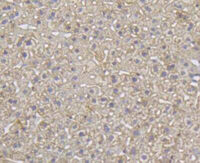Immunohistochemistry: ITPR2 Antibody [NBP2-76937] - Immunohistochemical analysis of paraffin-embedded mouse liver tissue using anti-ITPR2 antibody. Counter stained with hematoxylin.