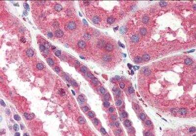 Immunohistochemistry-Paraffin: ITPR2 Antibody [NB100-2466] - (3.75ug/ml) staining of paraffin embedded Human Kidney. Steamed antigen retrieval with citrate buffer pH 6, AP-staining.