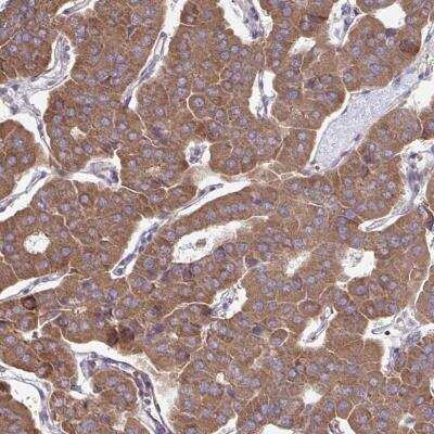 Immunohistochemistry-Paraffin: ITPR2 Antibody [NBP2-49294] - Staining of human parathyroid gland shows cytoplasmic positivity in glandular cells.