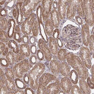 Immunohistochemistry-Paraffin: ITPR2 Antibody [NBP2-49294] - Staining of human kidney shows moderate to strong granular cytoplasmic positivity in cells in tubules.