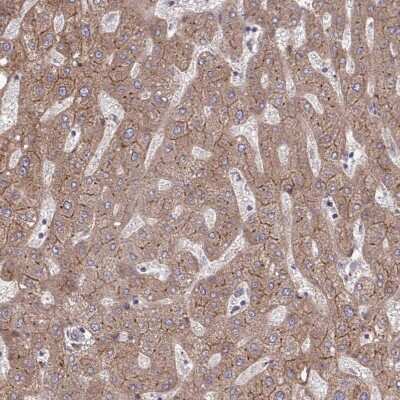 Immunohistochemistry-Paraffin: ITPR2 Antibody [NBP2-49294] - Staining of human liver shows moderate cytoplasmic and membranous positivity in hepatocytes.