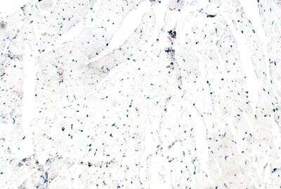 Immunohistochemistry-Paraffin: ITPR2 Antibody [NBP3-12318] - Mouse heart. 1:50 dilution in IHC blocking buffer. DAB (brown) staining and Hematoxylin QS (blue) counterstain.  20X mangification.