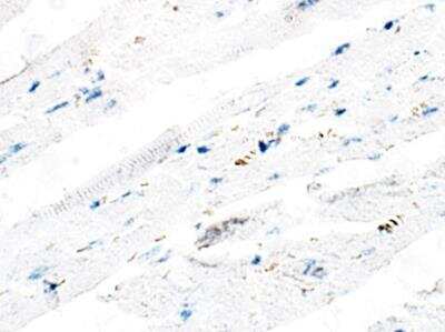 Immunohistochemistry-Paraffin: ITPR2 Antibody [NBP3-12318] - Mouse heart. 1:50 dilution in IHC blocking buffer. DAB (brown) staining and Hematoxylin QS (blue) counterstain. 40Xmangification.
