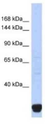 Western Blot: ITPR2 Antibody [NBP3-10355] - Western blot analysis of ITPR2 in Fetal Small Intestine lysates. Antibody dilution at 1.0ug/ml