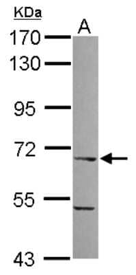 Western Blot ITPRIPL1 Antibody