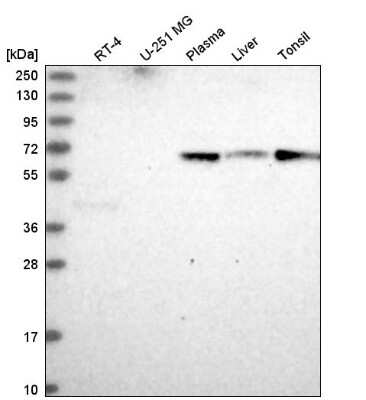 Western Blot: ITPRIPL2 Antibody [NBP2-58997] - Western blot analysis in human cell line RT-4, human cell line U-251 MG, human plasma, human liver tissue and human tonsil tissue.