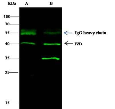 Immunoprecipitation: IVD Antibody (04) [NBP3-06536] - Lane A:0.5 mg Jurkat Whole Cell LysateLane B:0.5 mg A549 Whole Cell Lysate0.5 uL anti-IVD mouse monoclonal antibody and 15 ul of 50 % Protein G agarose.Primary antibody:Anti-IVD mouse monoclonal antibody,at 1:500 dilution Secondary antibody:Dylight 800-labeled antibody to Mouse IgG (H+L), at 1:7500 dilutionDeveloped using the odssey technique.Performed under reducing conditions.Predicted band size: 40 kDaObserved band size: 40 kDa