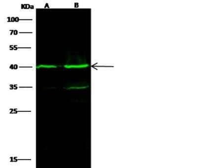 Western Blot: IVD Antibody (04) [NBP3-06536] - Lane A: Jurkat Whole Cell LysateLane B: Hela Whole Cell LysateLysates/proteins at 30 ug per lane.SecondaryGoat Anti-Mouse IgG H&L (Dylight800) at 1/15000 dilution.Developed using the Odyssey technique. Performed under reducing conditions.Predicted band size:47 kDaObserved band size:40 kDa