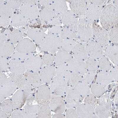 Immunohistochemistry-Paraffin: IVD Antibody [NBP2-30578] - Staining of human skeletal muscle shows low expression as expected.