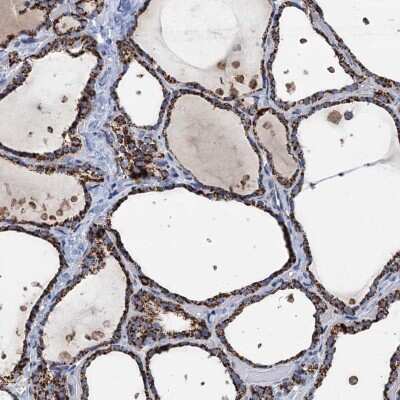 Immunohistochemistry-Paraffin: IVD Antibody [NBP2-30578] - Staining of human thyroid gland shows high expression.