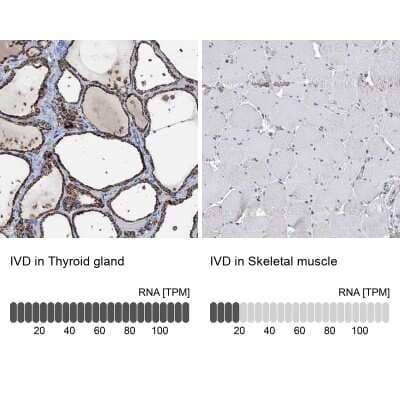 <b>Orthogonal Strategies Validation. </b>Immunohistochemistry-Paraffin: IVD Antibody [NBP2-30578] - Staining in human thyroid gland and skeletal muscle tissues using anti-IVD antibody. Corresponding IVD RNA-seq data are presented for the same tissues.