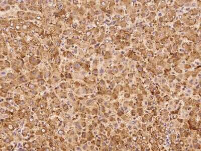 Immunohistochemistry-Paraffin: IVD Antibody [NBP2-99159] - Immunochemical staining of human IVD in human liver with rabbit polyclonal antibody at 1:1000 dilution, formalin-fixed paraffin embedded sections.