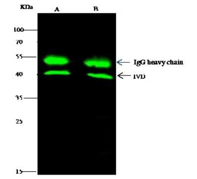 Immunoprecipitation: IVD Antibody [NBP3-00257] - IVD was immunoprecipitated using: Lane A: 0.5 mg Jurkat Whole Cell Lysate. Lane B: 0.5 mg A549 Whole Cell Lysate. 2 ul anti-IVD rabbit polyclonal antibody and 15 ul of  50 %  Protein G agarose. Primary antibody: Anti-IVD rabbit polyclonal antibody, at 1:100 dilution. Secondary antibody: Dylight 800-labeled antibody to rabbit IgG (H+L), at 1:5000 dilution. Developed using the Odyssey technique. Performed under reducing conditions. Predicted band size: 40 kDa. Observed band size: 40 kDa