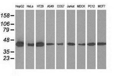 Western Blot: IVD Antibody (OTI1B10) - Azide and BSA Free [NBP2-71055] - Analysis of extracts (35ug) from 9 different cell lines by using anti-IVD monoclonal antibody.