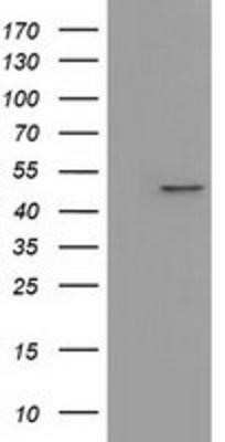 Western Blot: IVD Antibody (OTI1B10) - Azide and BSA Free [NBP2-71055] - HEK293T cells were transfected with the pCMV6-ENTRY control (Left lane) or pCMV6-ENTRY IVD (Right lane) cDNA for 48 hrs and lysed. Equivalent amounts of cell lysates (5 ug per lane) were separated by SDS-PAGE and immunoblotted with anti-IVD.