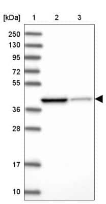 Western Blot: IVD Antibody [NBP2-30578] - Lane 1: Marker  [kDa] 250, 130, 95, 72, 55, 36, 28, 17, 10.  Lane 2: Human cell line RT-4.  Lane 3: Human cell line U-251MG sp