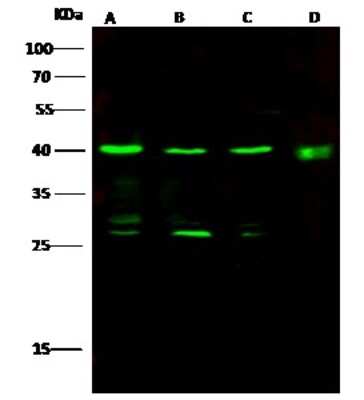 Western Blot: IVD Antibody [NBP3-00257] - Anti-IVD rabbit polyclonal antibody at 1:500 dilution. Lane A: IVD knockout Hela Whole Cell Lysate. Lane B: Hela Whole Cell Lysate. Lysates/proteins at 10 ug per lane. Secondary Goat Anti-Rabbit IgG (H+L)/HRP at 1/10000 dilution. Developed using the ECL technique. Performed under reducing conditions. Predicted band size: 46 kDa. Observed band size: 44 kDa