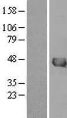 Western Blot: IVD Overexpression Lysate (Adult Normal) [NBL1-12088] Left-Empty vector transfected control cell lysate (HEK293 cell lysate); Right -Over-expression Lysate for IVD.