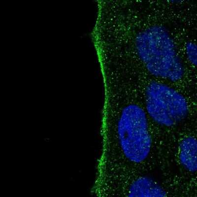 Immunocytochemistry/Immunofluorescence: IYD Antibody [NBP2-31786] - Staining of human cell line CACO-2 shows localization to plasma membrane.