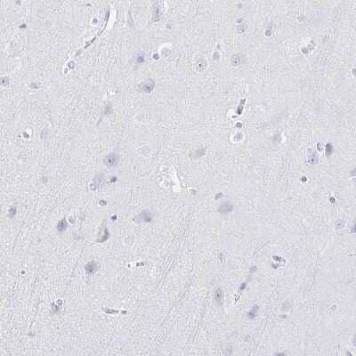 Immunohistochemistry-Paraffin IYD Antibody