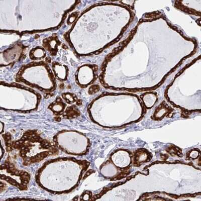 Immunohistochemistry-Paraffin IYD Antibody