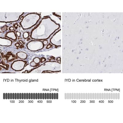 Western Blot: IYD Antibody [NBP2-31786] - Staining in human thyroid gland and cerebral cortex tissues using anti-IYD antibody. Corresponding IYD RNA-seq data are presented for the same tissues.