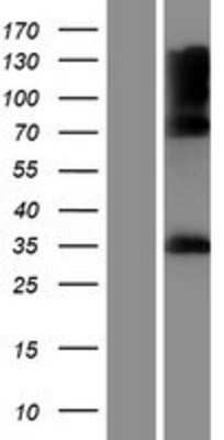 Western Blot: IYD Overexpression Lysate (Adult Normal) [NBP2-10140] Left-Empty vector transfected control cell lysate (HEK293 cell lysate); Right -Over-expression Lysate for IYD.