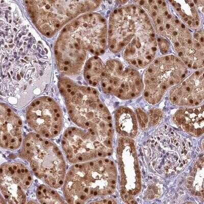 Immunohistochemistry-Paraffin: IZUMO2 Antibody [NBP1-90720] - Staining of human kidney shows strong nuclear positivity in cells in tubules.