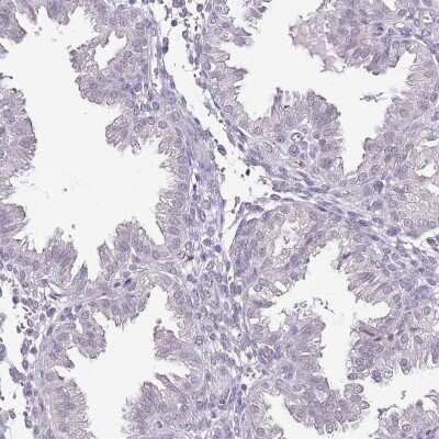 Immunohistochemistry-Paraffin: IZUMO4 Antibody [NBP2-30881] - Staining of human endometrium shows low expression as expected.