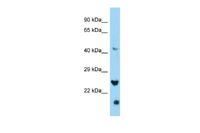 Western Blot: IZUMO4 Antibody [NBP2-83092] - WB Suggested Anti-IZUMO4 Antibody. Titration: 1.0 ug/ml. Positive Control: HepG2 Whole Cell