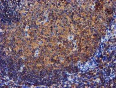 Immunohistochemistry-Paraffin: Iduronate 2-Sulfatase/IDS Antibody (1D9) [NBP2-01745] - Staining of paraffin-embedded Human tonsil using anti-Iduronate 2 sulfatase mouse monoclonal antibody.