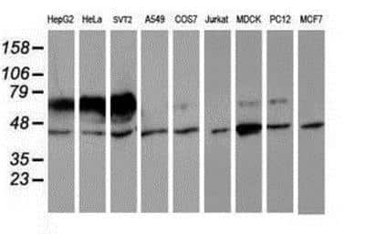 Western Blot: Iduronate 2-Sulfatase/IDS Antibody (4G2) [NBP2-01761] - Analysis of extracts (35ug) from 9 different cell lines by using anti-Iduronate 2 sulfatase monoclonal antibody.