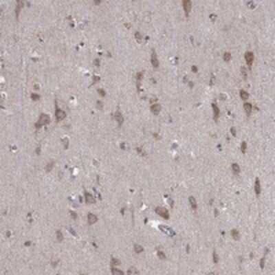 Immunohistochemistry-Paraffin: Iduronate 2-Sulfatase/IDS Antibody [NBP3-17659] - Staining of human cerebral cortex shows moderate cytoplasmic positivity in neuronal cells.