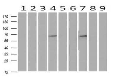 Western Blot: Iduronate 2-Sulfatase/IDS Antibody (OTI1D9) - Azide and BSA Free [NBP2-70994] - Analysis of extracts (10ug) from Human tissues by using anti-IDS monoclonal antibody at 1:200 (1: Testis; 2: Omentum; 3: Uterus; 4: Breast; 5: Brain; 6: Liver; 7: Ovary; 8: Thyroid gland; 9: colon).